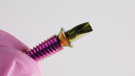 Dental orthopedist holds an implant and a screwed prosthesis on a white background