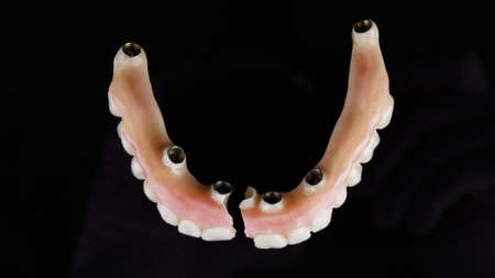 broken temporary dental prosthesis of the upper jaw from a polymer on a black background, top view