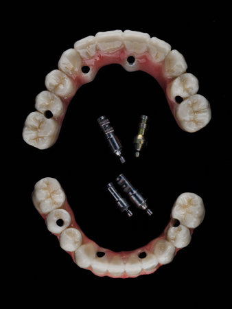 two dental prostheses with teeth relief for the upper and lower jaw, top view on a black backgroundの写真素材