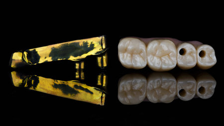 dental composition titanium bar and zircon denture bridge with tooth morphology on black glass with reflectionの写真素材