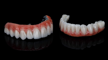 two excellent dental prostheses made of ceramics and titanium of the upper and lower jaws on a black backgroundの写真素材