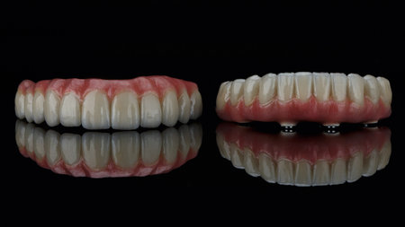 two excellent dental prostheses with gums on black glass and reflectionの写真素材