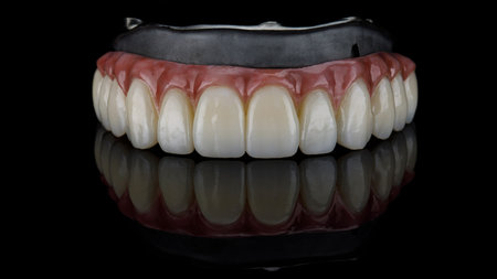 upper jaw prosthesis made of zircon and titanium bar on black background