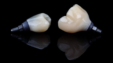 two dental crowns made of ceramic with prosthetics on black glass with creative reflectionの写真素材