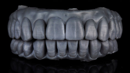 Dental prostheses in bite for fitting and diagnostics on black background