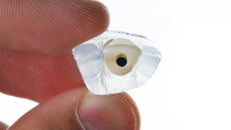 Hand holds dental crown on model, photo on white backgroundの写真素材