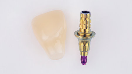temporary dental crown of the central tooth made of polymer and gold-colored abutment on a white...