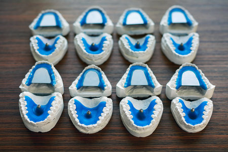 dental models made of plaster with supporting pins for registering the bite of patients