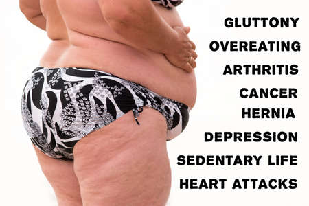 Obese woman isolated. Body of fat person. Save your health from danger. Risk of heart attacks.の写真素材
