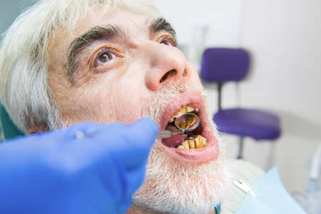 Elderly man with bad teeth. Hand is holding dental mirror.の写真素材