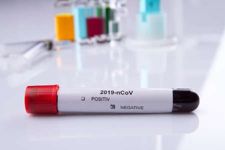 Close up tube with coronavirus blood test. White reflective background.