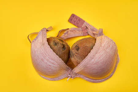 Concept of womans breast. Two coconuts and pink bra isolated on yellow background.の写真素材