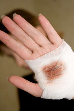 The injured hand of the girl tied up by white bandage