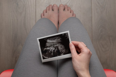 Pregnant woman and examines ultrasound images, sitting on chair, top view. Pregnancy concept.の写真素材