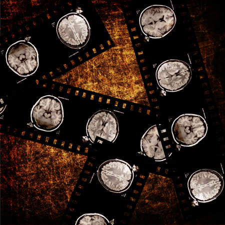 film with x-ray scans of brain on grunge backgroundの写真素材