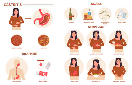 Gastritis, medical infographic vector illustration. Disease of digestive tract, causes, symptoms and treatment, abdominal pain and problems of female cartoon character. Medicine template designのイラスト素材