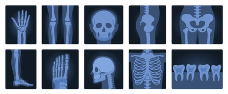 Xrays films of human body set, radiography and anatomy vector illustration. Cartoon isolated medical roentgen scans with silhouettes of bones of skeleton, joint and articulation of legs and handsのイラスト素材