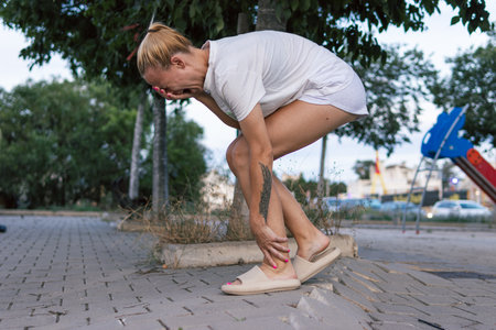 a girl of European appearance in shorts and, standing on the street holding her leg and screamingの写真素材