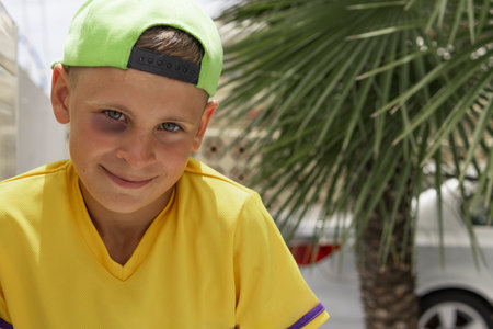 a boy with a black eye sits in the park, portrait of a boy in a cap with a black eyeの写真素材
