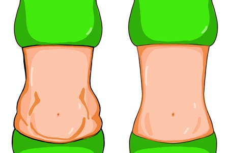 Female ,fit belly and fat belly illustration.のイラスト素材