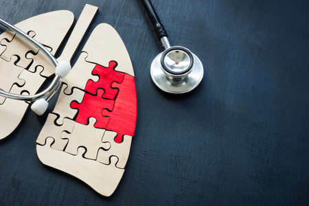 Model of the lungs with the diseased part. Cancer or Ground glass opacity GGO.の写真素材