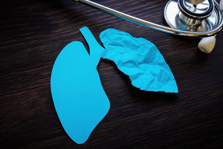 Stethoscope and one crumpled paper lung as a ground glass opacity after covid.の写真素材