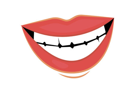 Emotion lips in flat cartoon design. In this stunning image the colorful style breathes life into the highly expressive, bright lips, revealing a spectrum of strong emotions. Vector illustration.のイラスト素材