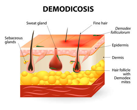 Vector of demodicosis. Demodex mite also - ID:1-35327977 - Royalty Free ...