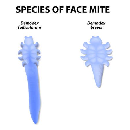 species of face mite. Demodex folliculorum and Demodex brevis. Demodex folliculorum lives in the hair follicles at the base of your eyelashes. Demodex brevis lives in oil glands connected to the hair follicles.のイラスト素材