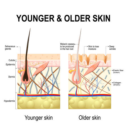 Human skin changes or ageing skin. A diagram of younger and older skin showing the decrease in collagen fibers, atrophy and broken elastin, formed wrinkles, hair becomes gray in the elderly.