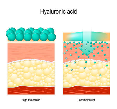 Hyaluronic acid. Hyaluronic acid in skin-care products. Low molecular and High molecular. Differenceのイラスト素材