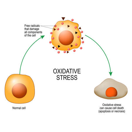 Oxidative stress. From Normal cell, to Oxidative stress and aggressive free radicals, cell death. Vector diagram for your design, educational, science and medical useのイラスト素材