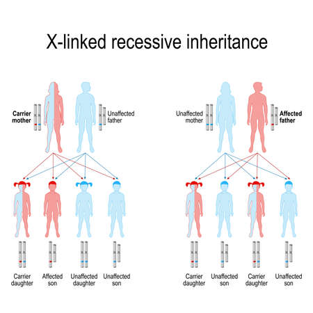 Vector of X-linked recessive inheritance - ID:106725594 - Royalty Free ...