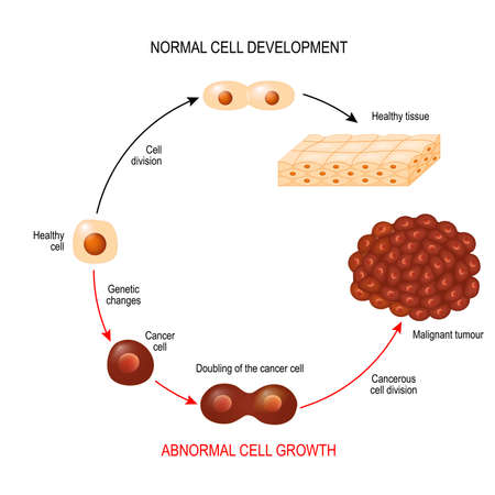 Vector of Cancer cell and normal cell. - ID:1-126522248 - Royalty Free ...
