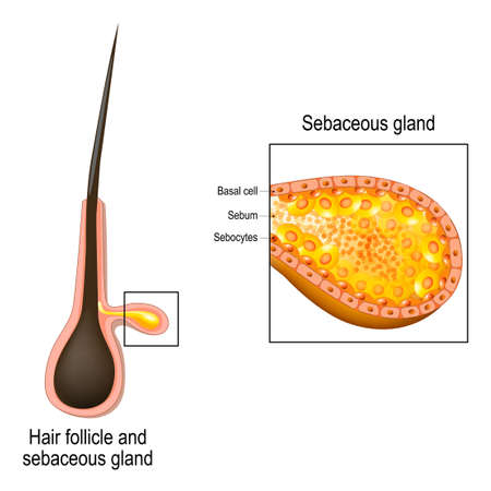 hair follicle. Cross section of sebaceous gland.  Close up of Sebocytes that secrete sebum (oily or waxy matter)のイラスト素材