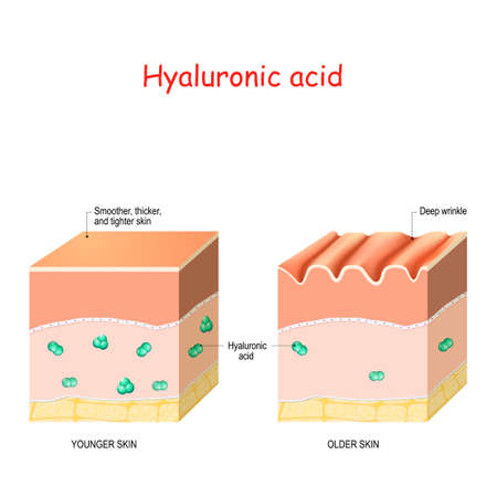 Hyaluronic acid in younger and older skin. skin-care products and rejuvenation with help of hyaluronic acidのイラスト素材