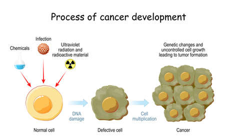 process of cancer development. Cancer causing agents and the stages of transforming normal cell to Defective cell and cancer. Genetic changes and uncontrolled cell growth leading to tumor formationのイラスト素材
