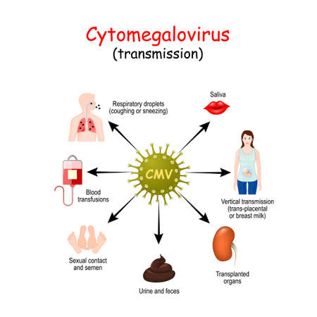 Cytomegalovirus infects humans. Virus that causes Mononucleosis, pneumonia. transmission of...