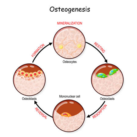 bone remodeling (resting, resorption, reversal, mineralization, formation). Describe a process of Ossification. osteogenesis. Bone is broken down by osteoclasts, and rebuilt by osteoblastsのイラスト素材