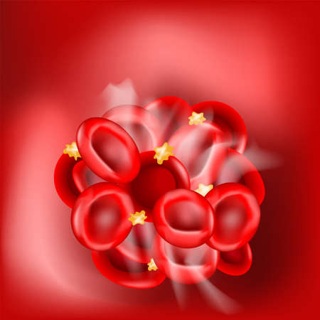 Blood clot on red background. thrombus that has blocked a blood vessel. blood coagulation. hemostasis. Vector illustrationのイラスト素材