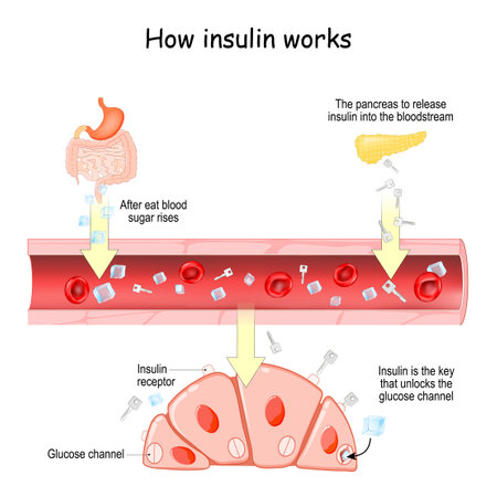 How insulin works. After eat blood sugar rises. After that the pancreas to release insulin into the bloodstream. Insulin is the key that unlocks the glucose channel in cellsのイラスト素材