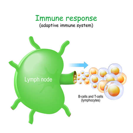 Lymph node and B-cells and T-cells. lymphocyte. Immune response. adaptive immune system. Lymphoma most commonly develops from lymphocytes in the lymph nodesのイラスト素材