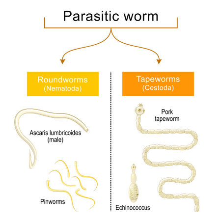 worm infections. Helminthiasis. Common types of parasitic worms or helminths: tapeworms, and roundworms that are infected of the human gastrointestinal tract. Pinworms and Ascaris lumbricoides, Pork tapeworm and Echinococcus. vector posterのイラスト素材