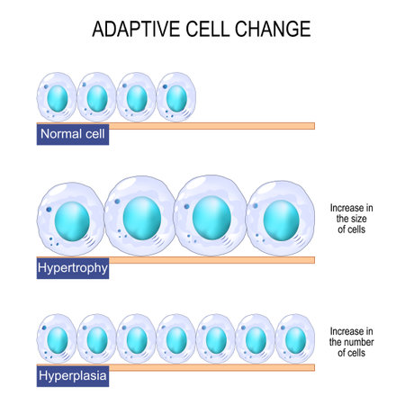 adaptive cell change. Normal cell, hypertrophy is an increase in the size of cells, and hyperplasia -increase in the number of cells. Vector Poster for education, science, and medical useのイラスト素材