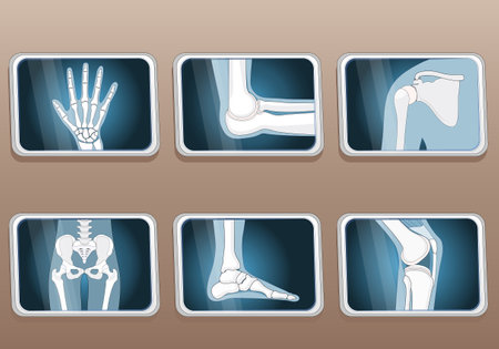 Types of joints. Knee, Elbow, wrist, hip, shoulder joints and Articulations of foot. Set icons. X-ray image. Isometric Flat vector illustration.のイラスト素材