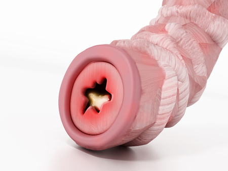 Obstructed bronchial tube illustration representing asthma. 3D illustration.の写真素材