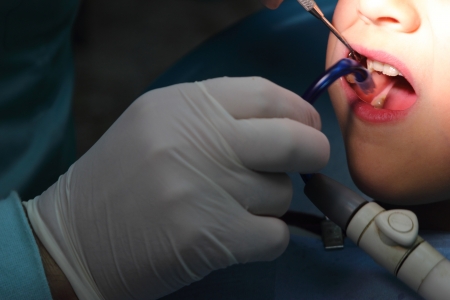 Dental care for a kid close-upの写真素材