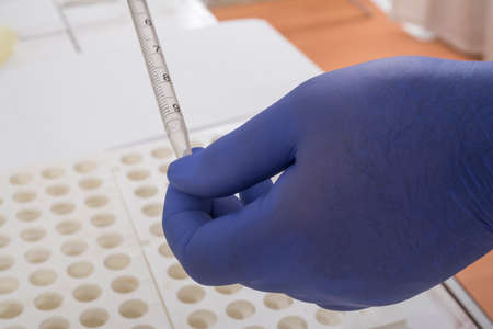 Genuine photo of blood analysis - No fictionの写真素材