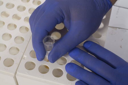 Blood analysys detail in laboratory