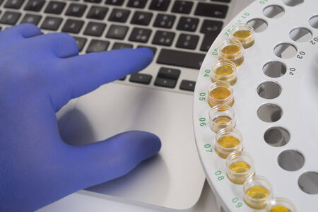 Blood analysys: hand, keyboard and tubesの写真素材